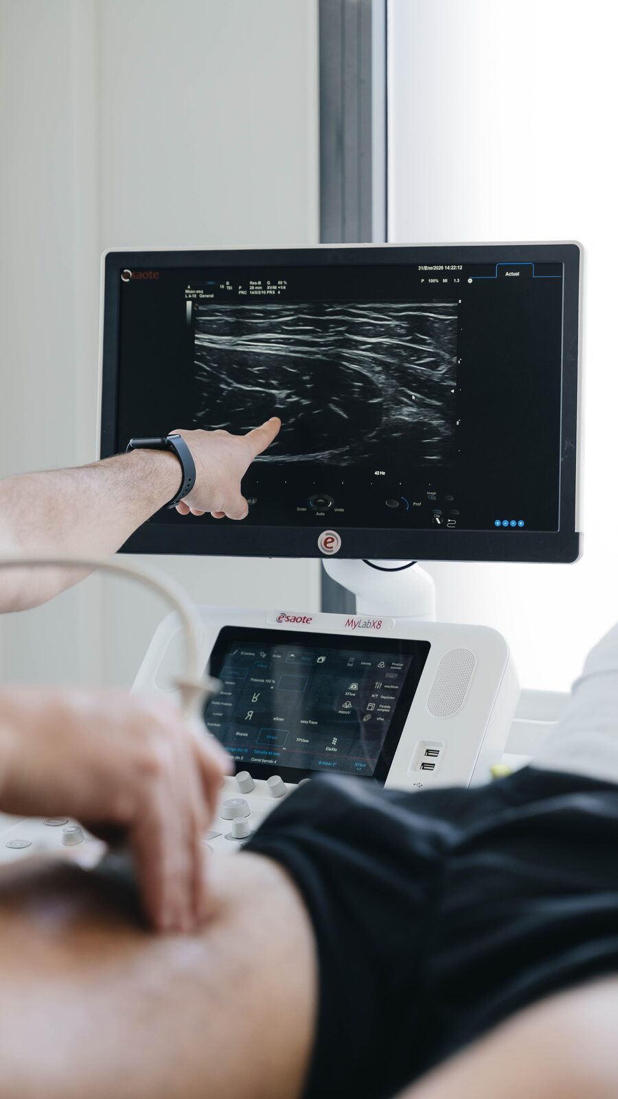 Equip de Fisunic a la clínica de Sant Cugat del Vallès